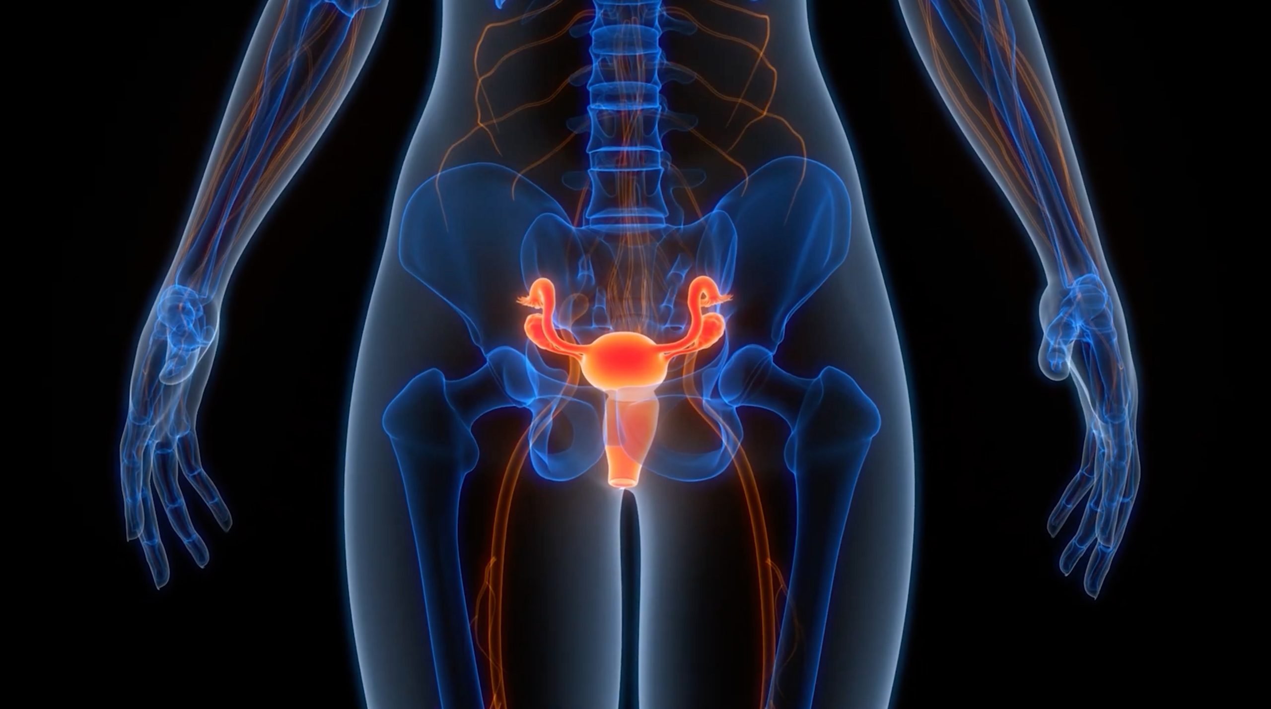 Ovarian cancer breakthrough